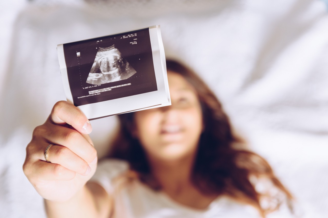 pregnant-woman-holding-ultrasound-scan-2021-08-29-10-28-09-utc